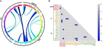 Impaired large-scale cortico–hippocampal network connectivity, including the anterior temporal and posterior medial systems, and its associations with cognition in patients with first-episode schizophrenia